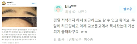 눈썹리프팅 수술 없이 시원한 눈매 완성하는 방법 관련 이미지 13