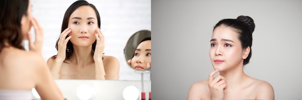 콧등주름, 보톡스로 효과 보기 위한 2가지 꿀팁 관련 이미지 2