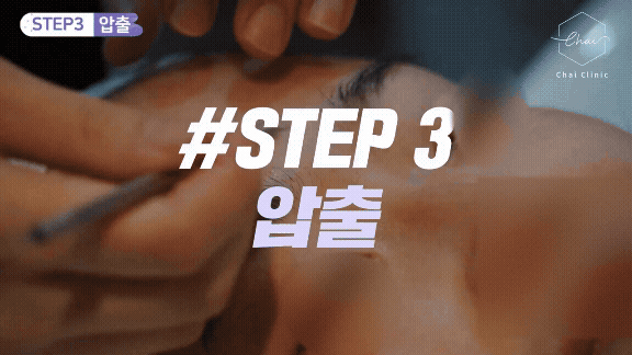 홍대 LDM 효과 보려면 3가지만 확인하세요 관련 이미지 6