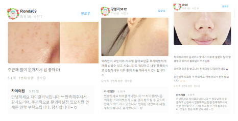 관자놀이보톡스 큰바위얼굴 고민해결 관련 이미지 17