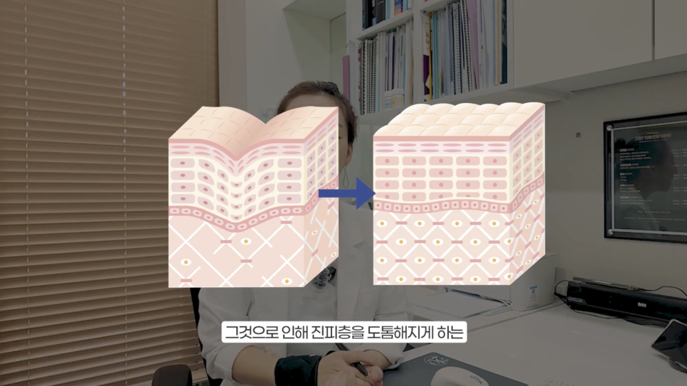 쥬베룩 볼륨 부작용을 예방하려면? 관련 이미지 2