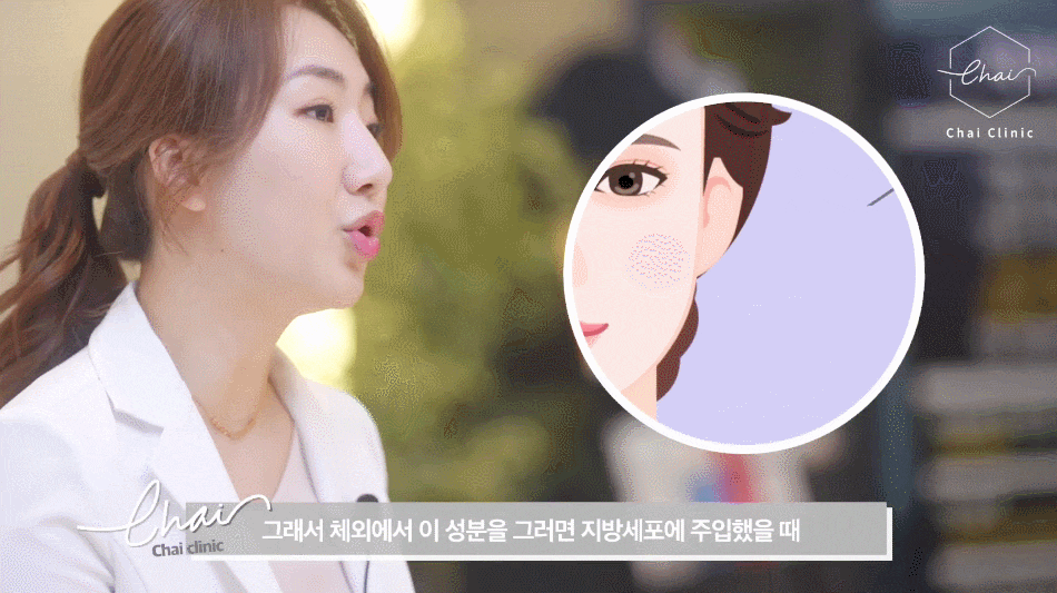 브이라인주사 달덩이 같던 얼굴이 반쪽으로! 관련 이미지 2