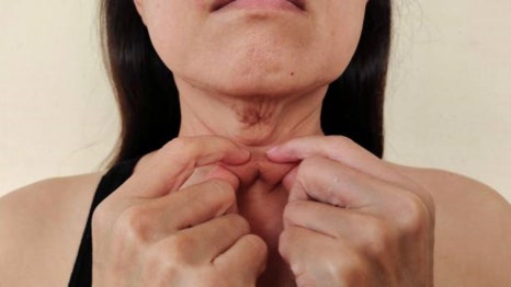 합정역피부관리 인모드보다 강력한 &lsquo;OOO&rsquo; 리프팅? 관련 이미지 2