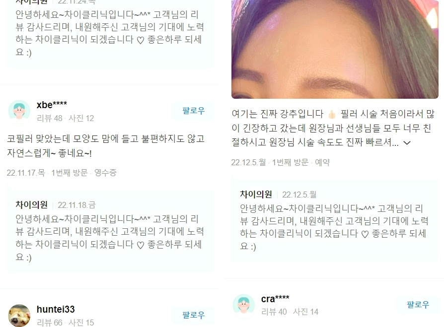 처진볼살리프팅 관련 이미지 11