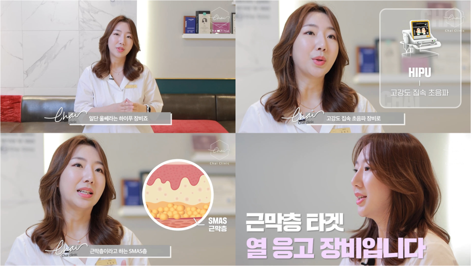 눈꼬리리프팅 관련 이미지 4