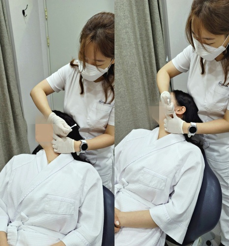 스킨보톡스 효과시기 이때가 가장 좋습니다 관련 이미지 5