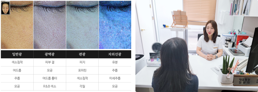 피부색소침착레이저 치료, 이걸 몰랐다면 당신은 유죄! 관련 이미지 3