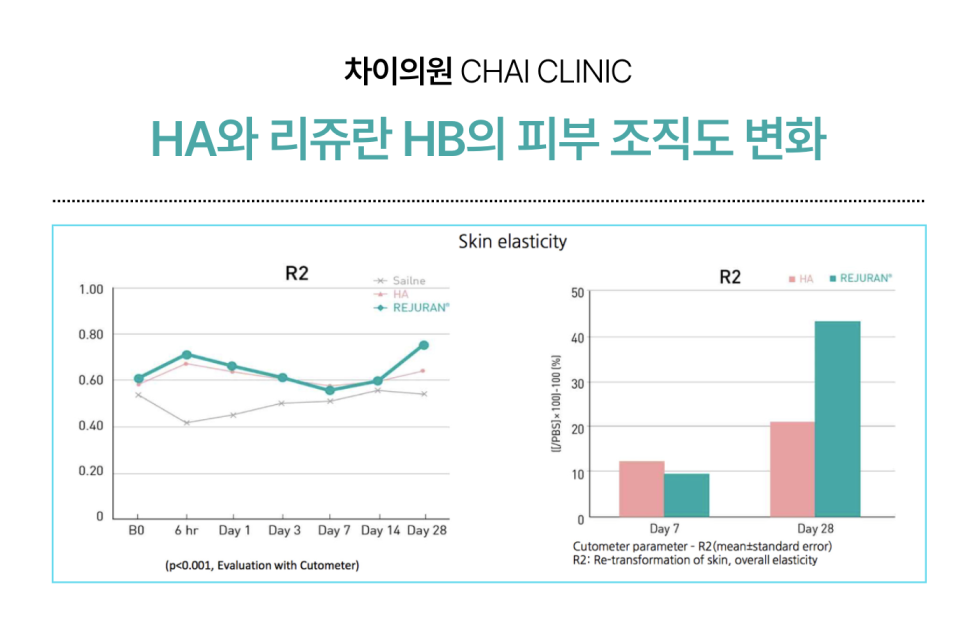 리쥬란 HB 효과와 부작용, 통증, 유지기간 총망라! 관련 이미지 2