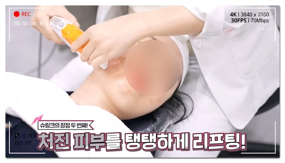 슈링크 효과 언제부터일까? 시기별 효과 및 유지기간 총정리 관련 이미지 4