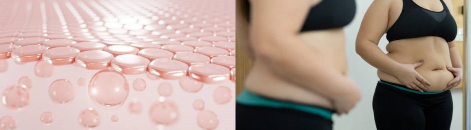합정역몸매관리 차이의원 탄력 울핏 인스타바프 프로그램 관련 이미지 11