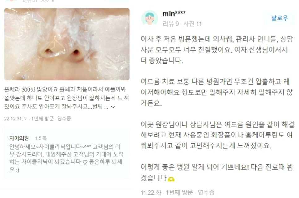 레이저토닝효과 제대로 보고 싶다면 ‘이것’ 중요합니다. 관련 이미지 14