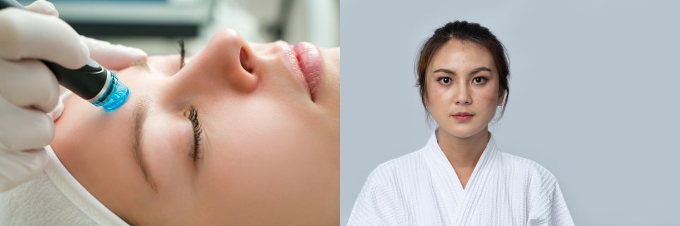 피부관리기미치료 거뭇거뭇한 기미 왜 생기는 걸까? 관련 이미지 6