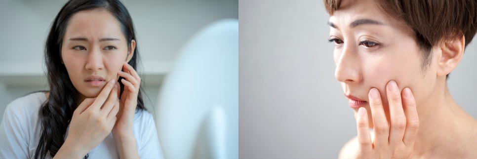 기미레이저토닝도 나에게 맞춤 관리가 필요한 이유 관련 이미지 2