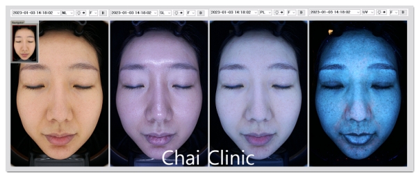 How Does Dual Toning Differ from Regular Laser Toning? image 9
