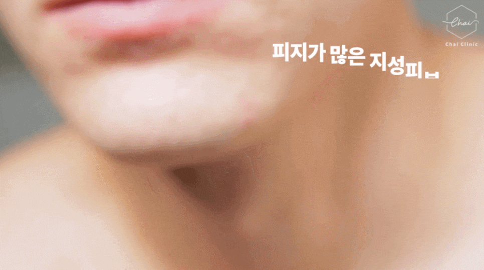 합정 물광주사 효과, 주의점 의사가 알려드려요 관련 이미지 8