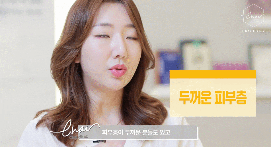 팔뚝 울핏 쉽고 빠르게 가녀린 팔 라인 완성 관련 이미지 9