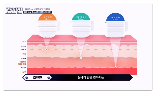 홍대 울쎄라 잘하는 곳 제대로 찾는 법 관련 이미지 4