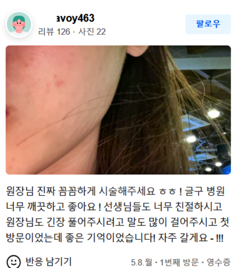 코레지리프팅, ‘이것’이 싫으신 분에게 추천! 관련 이미지 14