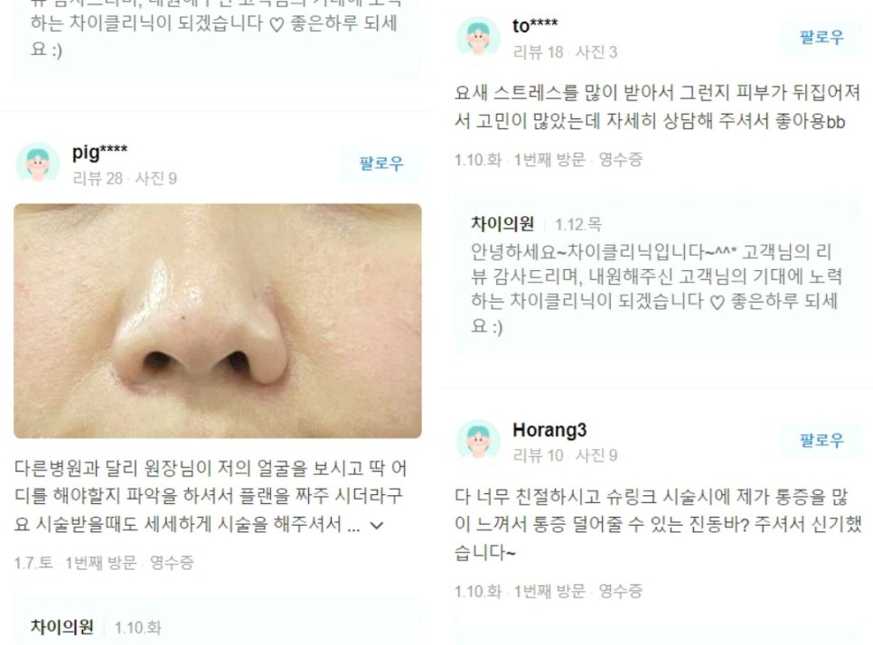 실루엣소프리프팅, 젊음의 생생함을 찾고 싶은 여러분에게 소개합니다. 관련 이미지 8