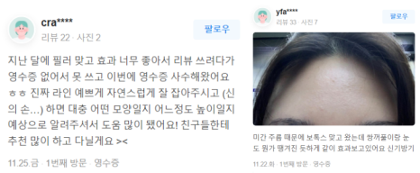 이마 실리프팅, &lsquo;OO&rsquo;을 잡아야 최상의 효과를 볼 수 있습니다. 관련 이미지 19