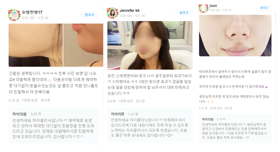 목리프팅 탄력저하 해결이 안 된다면 관련 이미지 20