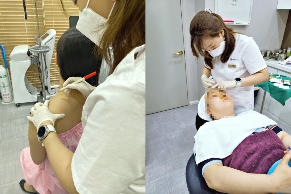 이마주름보톡스 미세주름이 오히려 어려운 이유! 관련 이미지 6