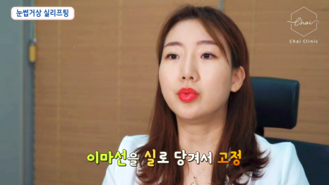 콜라겐실리프팅 차이의원에서 맞춤 디자인으로 받아 보세요 관련 이미지 11