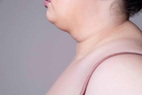 얼굴윤곽주사로 매끈한 얼굴라인 만들어보세요! 관련 이미지 2