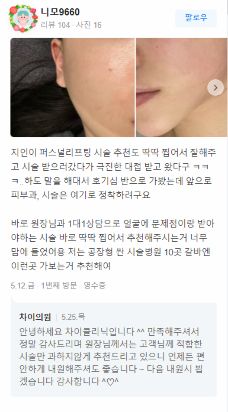 겨드랑이미백레이저 민소매도 자신 있게! 관련 이미지 14