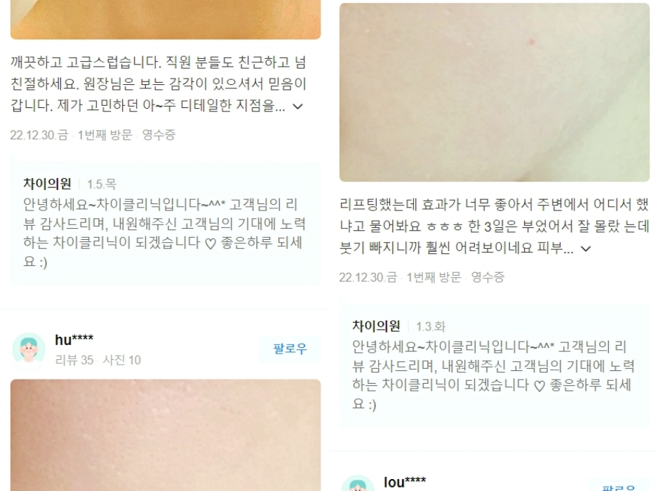 마포구피부관리 피부 탄력 높이는 특효약 실리프팅 관련 이미지 9