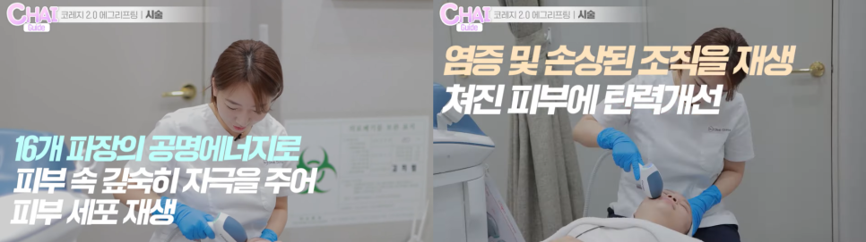 홍대입구피부관리 의사가 추천하는 ‘시술’ 궁금하시죠? 관련 이미지 3