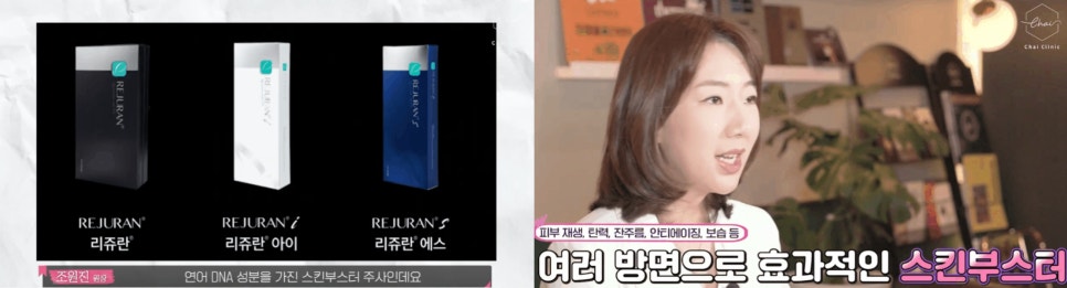 리쥬란HB플러스 고통 없이 예뻐지는 방법! 관련 이미지 2