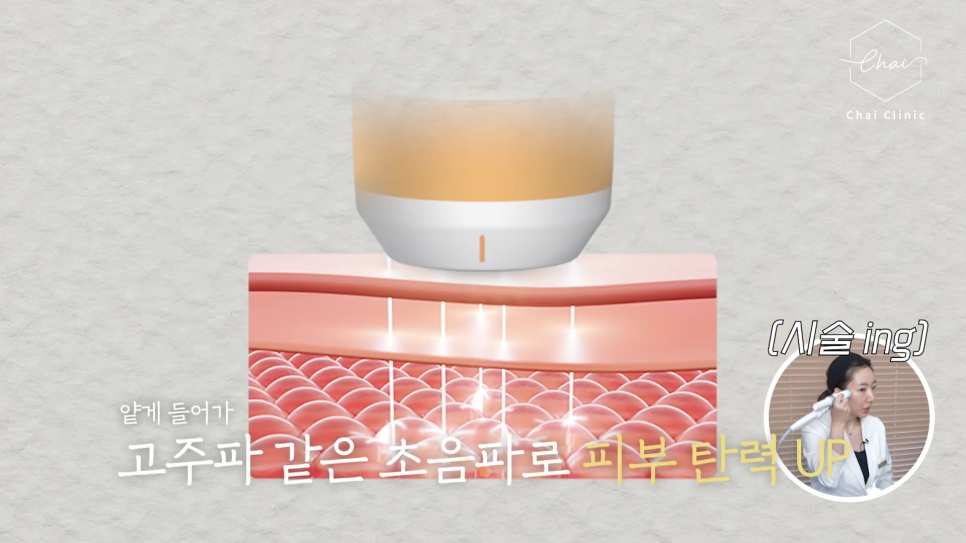 Hapjeong Shrink, the Procedure Even Doctors Get During the Autumn Seasonal Transition image 9
