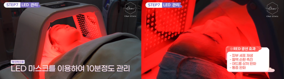 LDM물방울리프팅 효과 수분은 물론 탄력까지 찾아드려요 관련 이미지 12