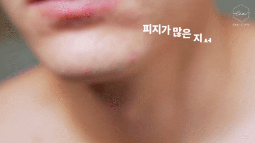 Hongdae Lalafil for Seasonal Rough Skin Care image 10