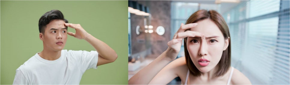 이마주름시술 필러와 보톡스만 있을까요? 관련 이미지 6