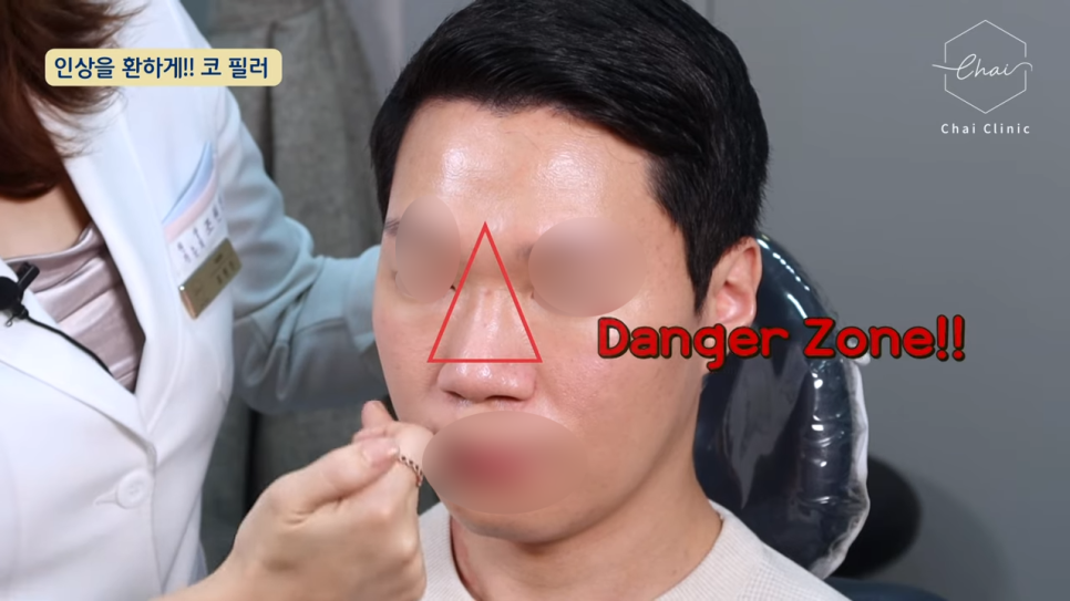 당산 필러 1:1 맞춤 시술을 통하여 안심하고 관련 이미지 5