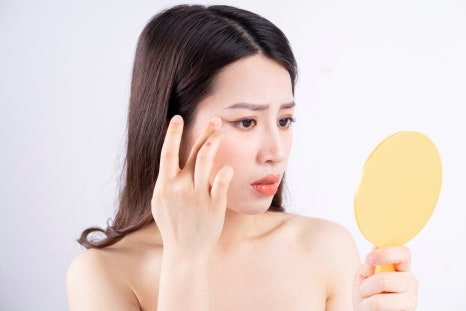 눈가주름보톡스 딱 3년 젊어지세요 관련 이미지 3
