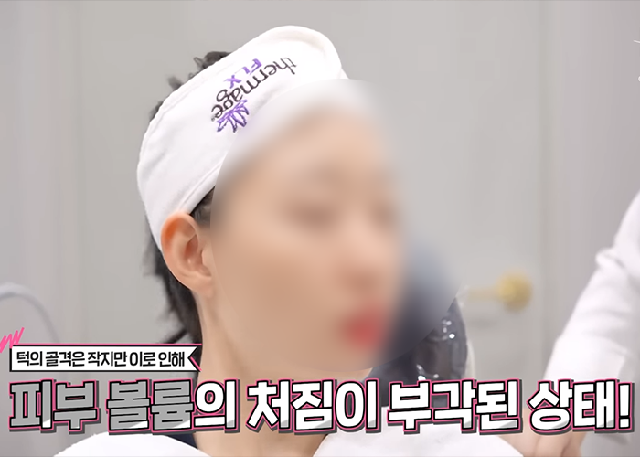 당산 슈링크 시술 받기 전에 읽어보세요 관련 이미지 3