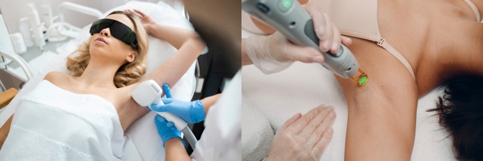겨드랑이 미백토닝으로 여름 준비하는 방법 관련 이미지 5