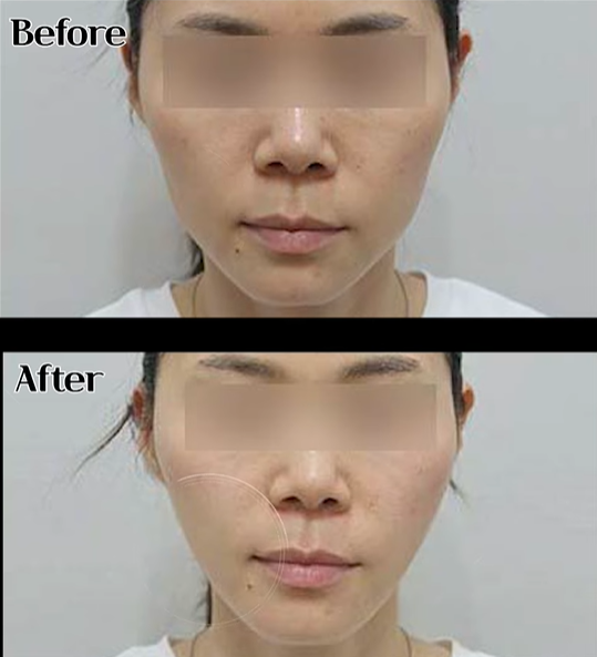 홍대 울써마지 모르면 300만원 날리는 3가지 관련 이미지 8