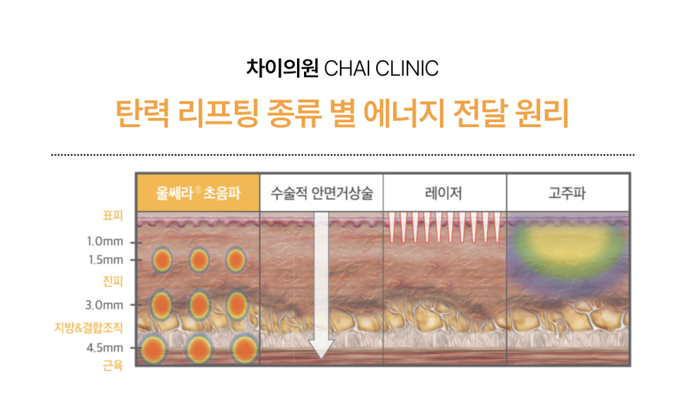 리프팅 맛집! 차이의원에서 피부 리프팅 연말 결산 해요! 관련 이미지 12