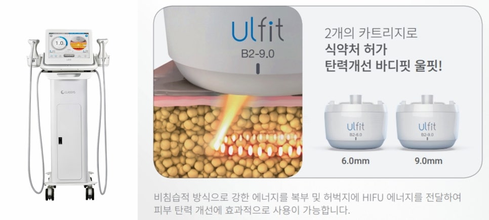 울핏 효과 및 추천 부위와 권장 횟수는? 관련 이미지 6