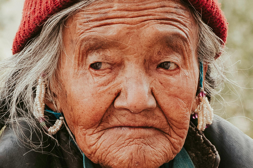 연남동 써마지, 탁월한 주름 개선을 원하는 20~50대 여성들이라면? 관련 이미지 2