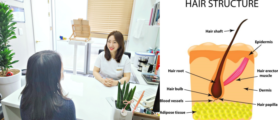 홍대여드름 흉터 예방, 치료방법 관련 이미지 1