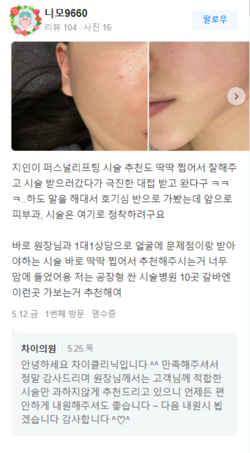 스킨부스터 종류? 나에게 딱 맞는 원픽 찾는법 관련 이미지 19
