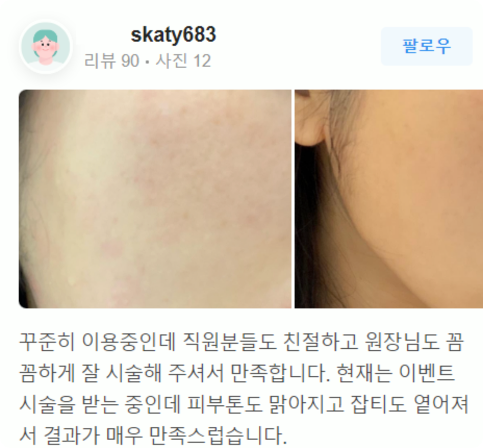 홍대피부관리 떨어지는 피부 탄력 확실하게 리프팅 하는 비결 (근처10분거리) 관련 이미지 16