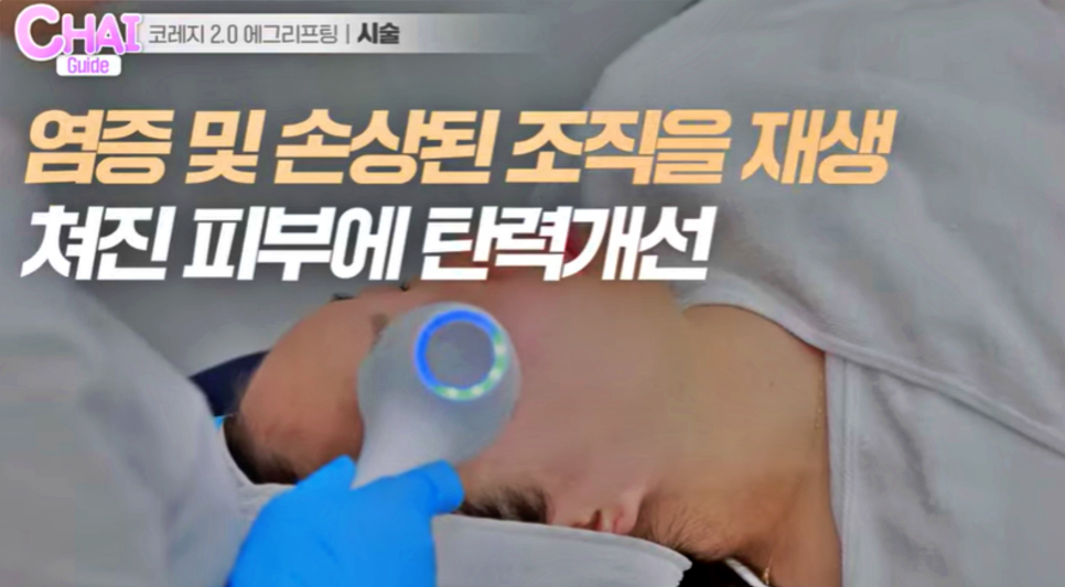 리프팅레이저 탄력? 주름? 이중턱? 차이에서 해결하세요 관련 이미지 7