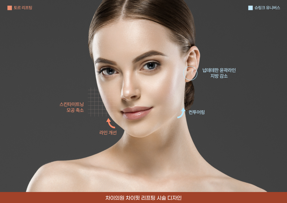 토르 리프팅과 슈링크 유니버스의 병행 시술, 차이핏 리프팅 관련 이미지 8