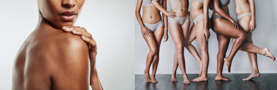 홍대여의사피부관리 늦기 전에 색소침착에서 벗어나는 법 관련 이미지 7